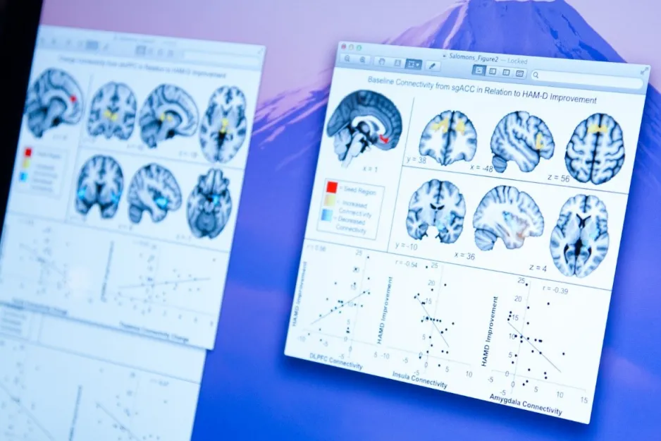 A close-up of a computer screen depicts multiple images of a brain on the screen.