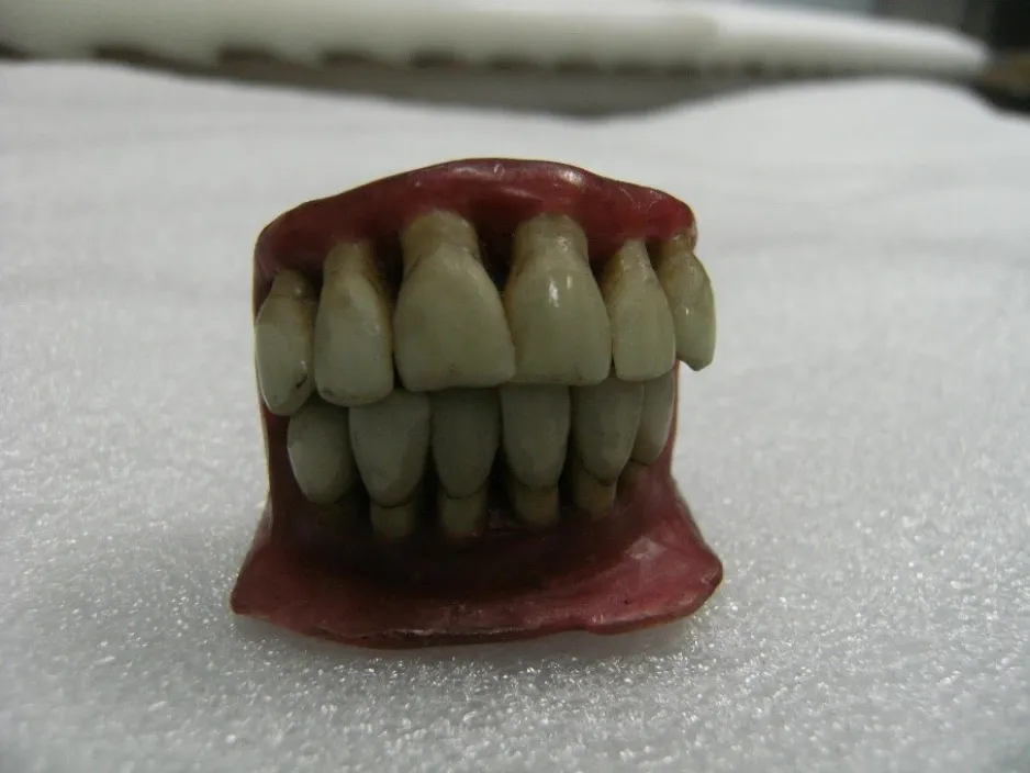 A wax model of a set of teeth sits on a foam surface; the teeth are yellowed and unsightly.